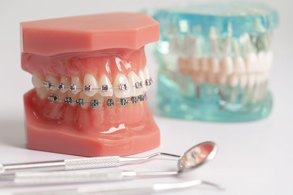 Treatment room at Rose Dental Group & Orthodontics